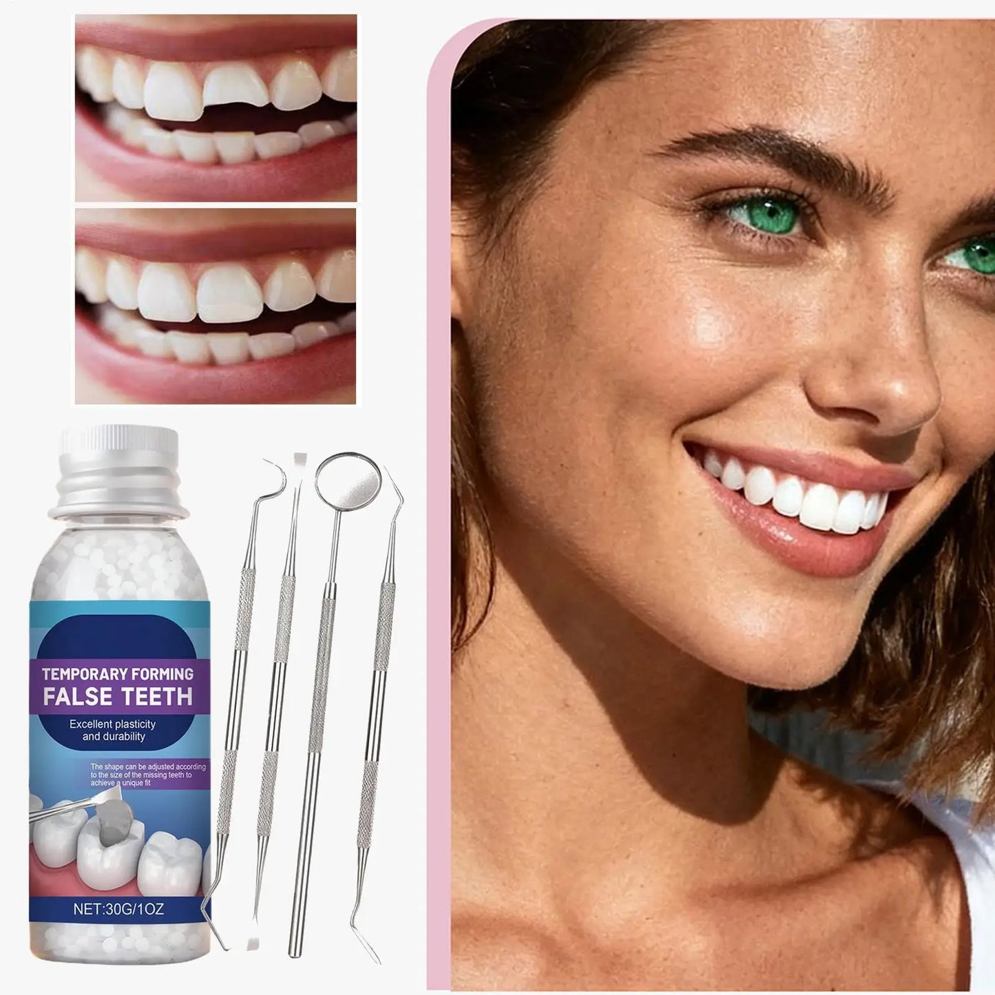 Teeth Repair Bonding Glue 30g Kit – Strong Hold & Natural Fit