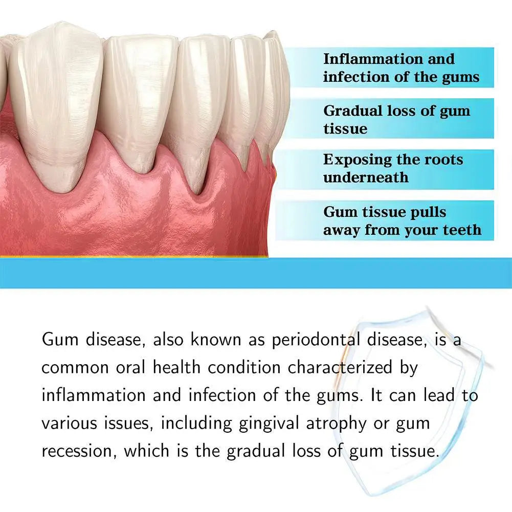 Gum Repair Drops 30ml – Sore Gum Relief & Teeth Cleaning Serum
