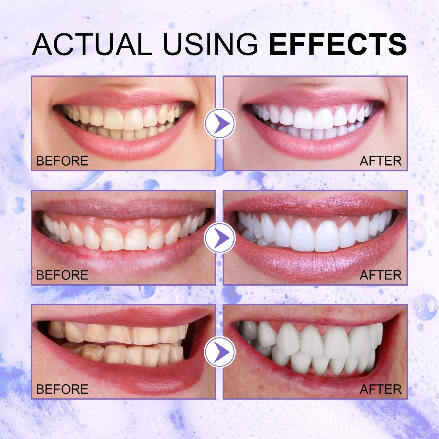 Purple Toothpaste Whitening Serum – Bright Smile & Fresh Breath