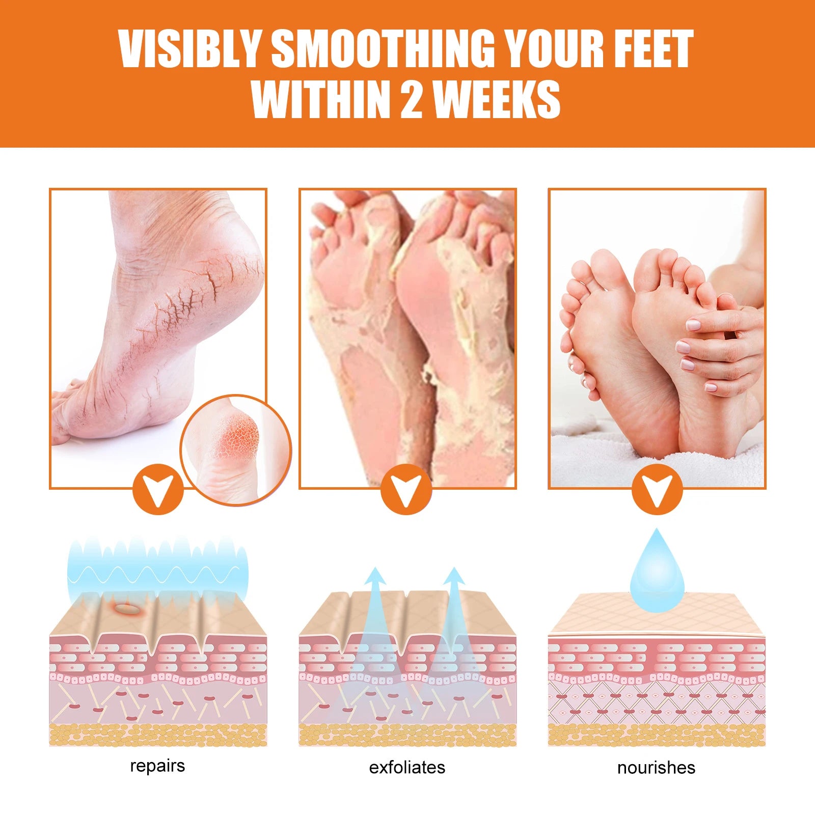 Jaysuing Exfoliating Foot Treatment Spray Remove Dead Skin Care Repair Skin Cracks Replenish Moisture Moisturize Soften Footcare Peaceful Pleasures Health and Wellness