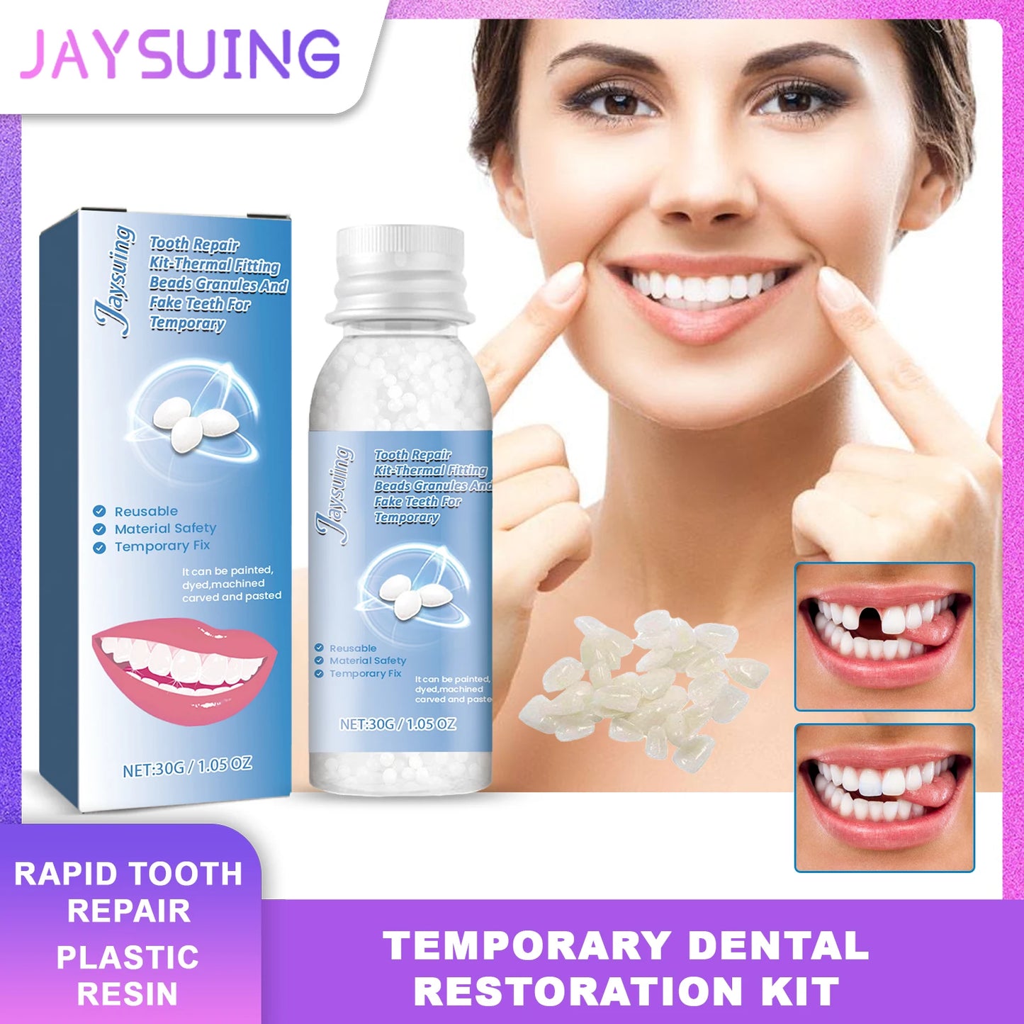 Temporary Tooth Repair Kit – DIY Dental Restoration Beads