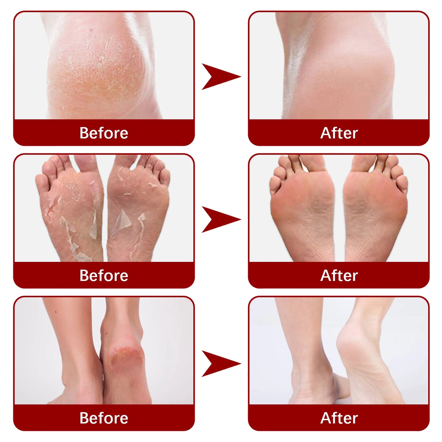 Jaysuing Exfoliating Foot Mask Moisturizing Pedicure Anti Crack Heel Foot Dead Skin Remover for Men Women Foot Care Beauty Peaceful Pleasures Health and Wellness