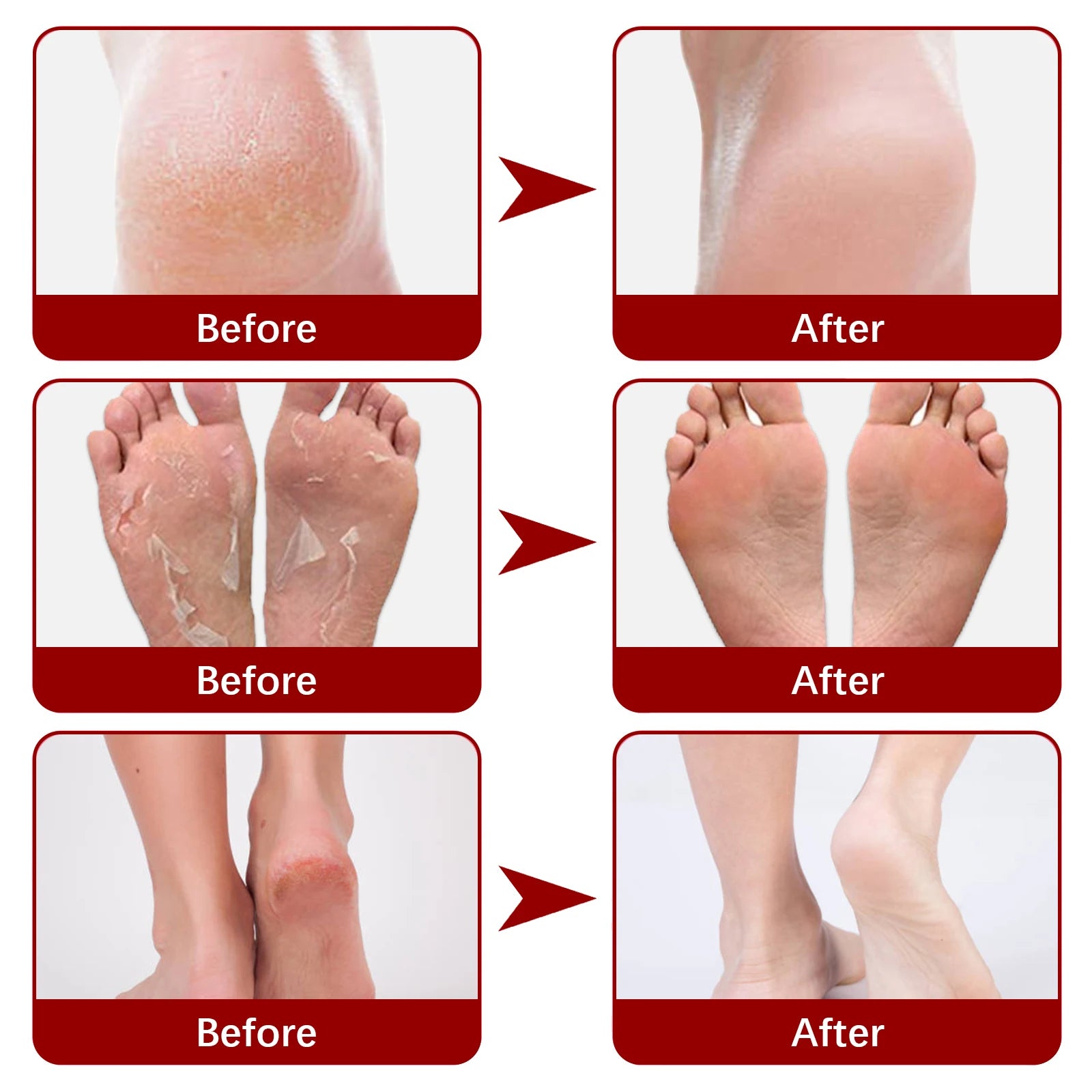 Jaysuing Exfoliating Foot Mask Moisturizing Pedicure Anti Crack Heel Foot Dead Skin Remover for Men Women Foot Care Beauty Peaceful Pleasures Health and Wellness