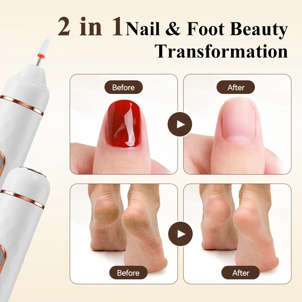 AFDEAL 2-in-1 Cordless Electric Nail Drill & Callus Remover Kit