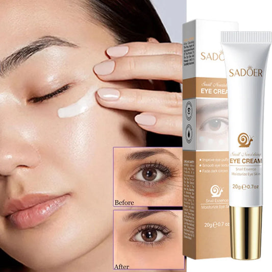 SADOER Snail Eye Cream – Dark Circles, Bags & Anti-Aging Eye Cream Oasis Select