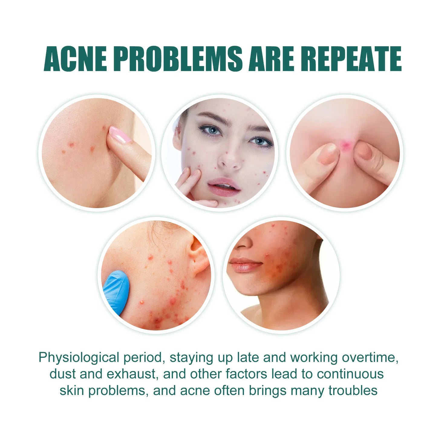 EELHOE Salicylic Acid Acne Patches 112pcs | Pimple Stickers