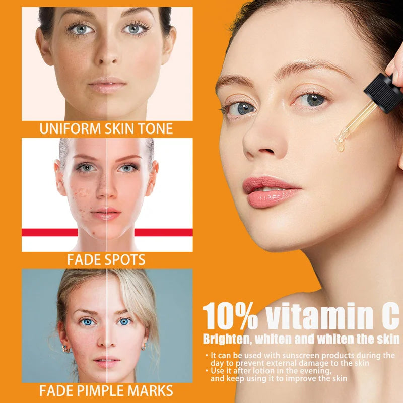 Vitamin C Face Serum – Dark Spot Remover & Brightening