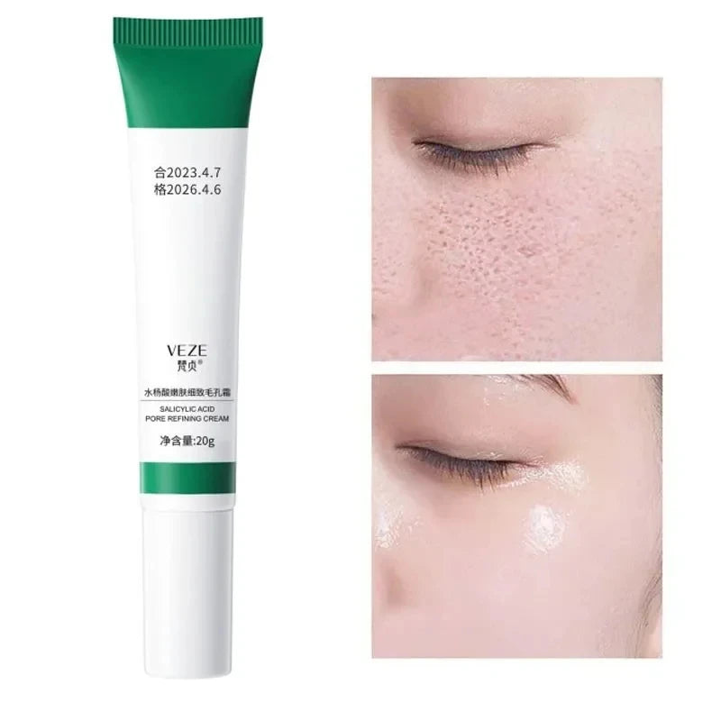 Salicylic Acid Pore Refining Cream – Oil Control & Blackhead