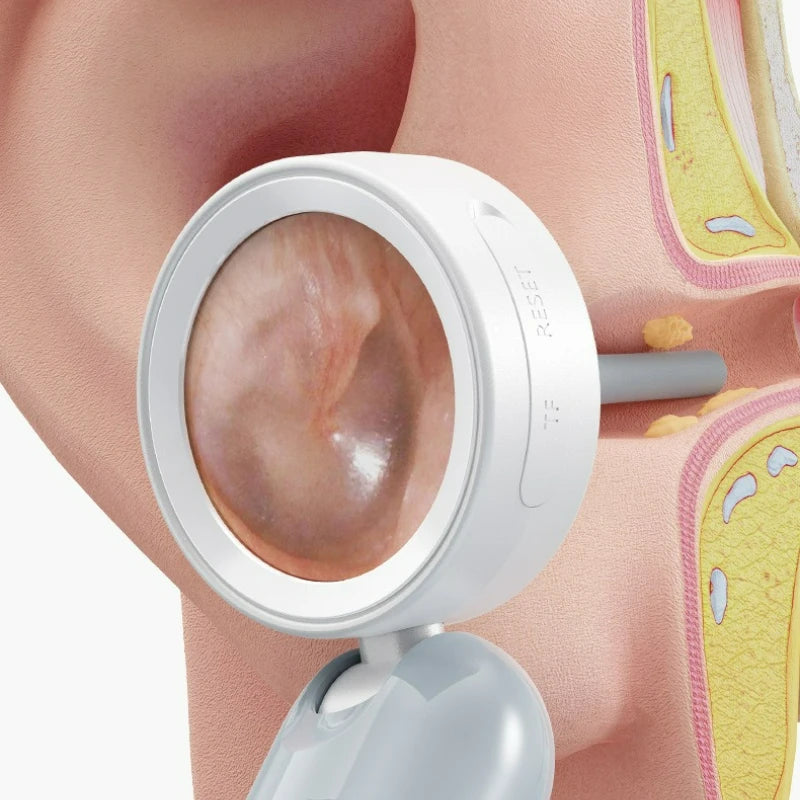 1.38'' Ear Camera Wit IPS Display and 1080P Camera Ear Check Portable Inspector for Ear Mouth Pet With 12tips Replaceable Tools Peaceful Pleasures Health and Wellness