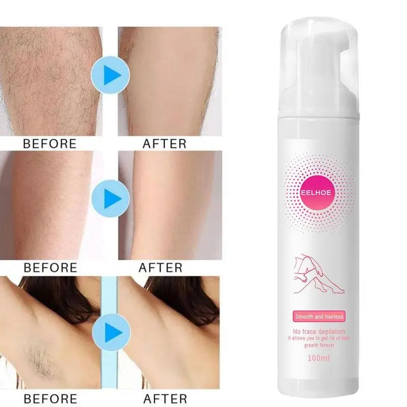 Hair Removal Foam Mousse Spray 30ml & 100ml – Gentle Formula