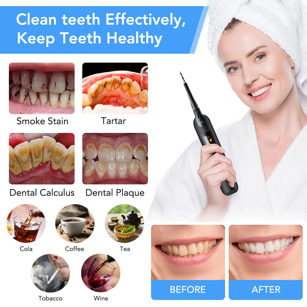 Teeth Tartar Remover Electric Sonic Dental Calculus and Plaque Remover With LED Light Teeth Whitening Kit Dental Tools At Home Peaceful Pleasures Health and Wellness