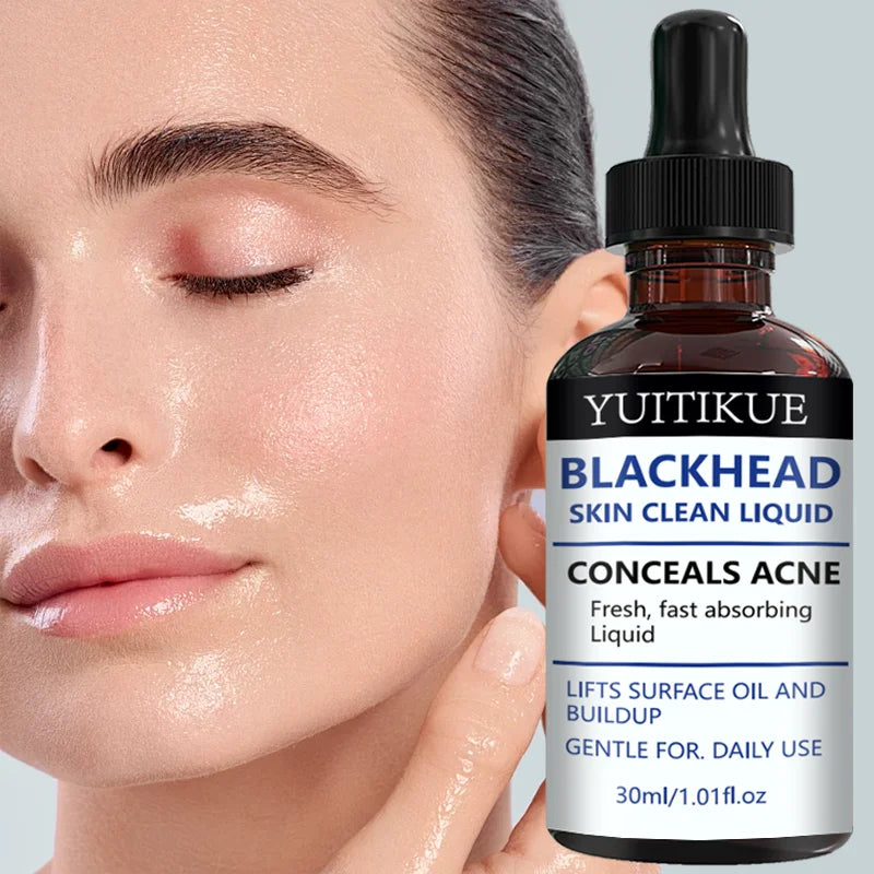 YUITIKUE Blackhead Remover Liquid Gentle Acne Oil Control Deep Cleansing Pore Refining Skin Care Peaceful Pleasures Health and Wellness