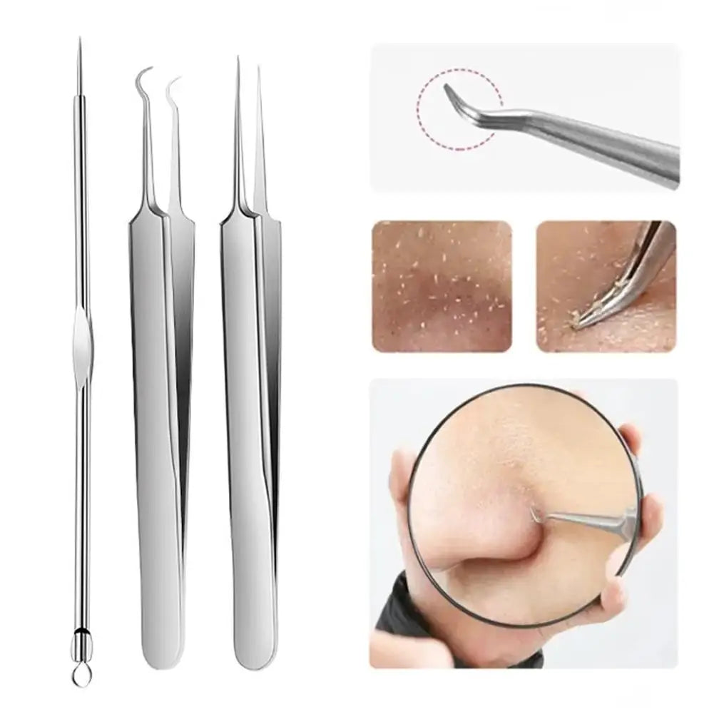 3-Piece Stainless Steel Acne Needle & Blackhead Remover Kit