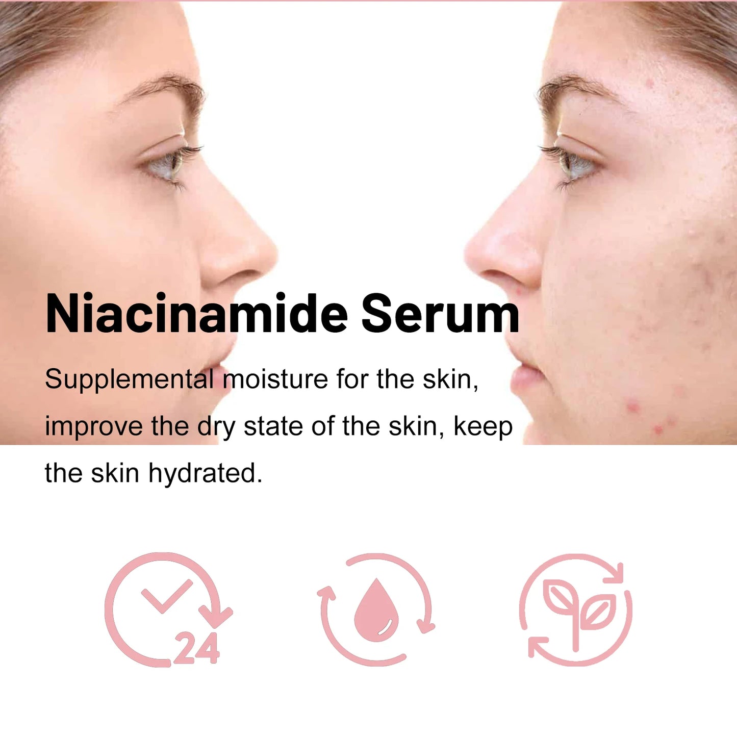 Ouhoe Nicotinamide Brightening Face Serum 30ml – Anti-Aging