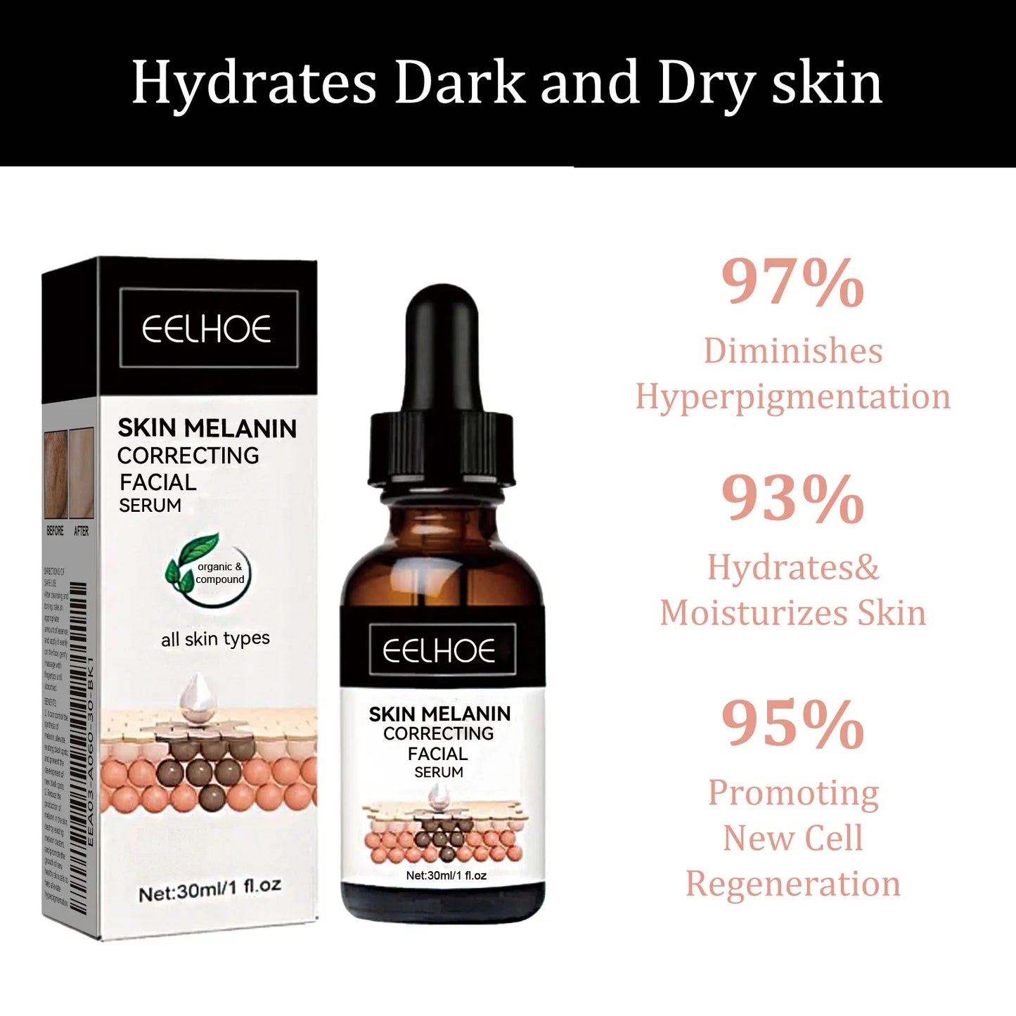 Niacinamide Dark Spot Correcting Serum – Fade & Brighten