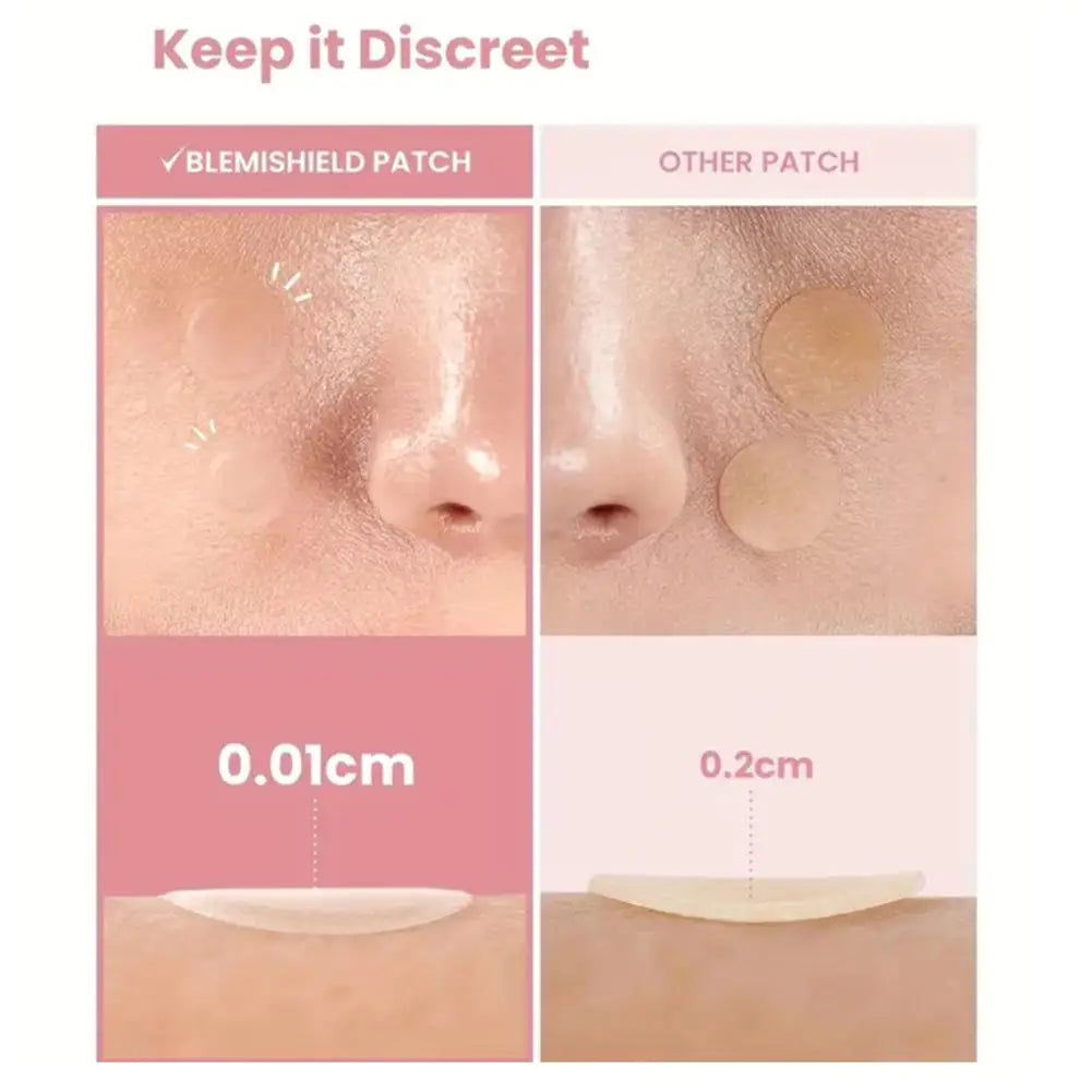 Cute Hydrocolloid Acne Patches 360 Pcs – Stars, Hearts & Dots for Face Breakouts Peaceful Pleasures Health and Wellness