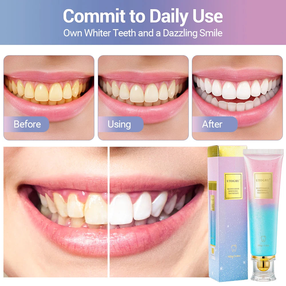 Niacinamide Teeth Whitening Toothpaste Reduce Yellow Stains on Teeth Mint Flavor Fresh Breath Toothpaste Home Gum Care Daily Use Peaceful Pleasures Health and Wellness