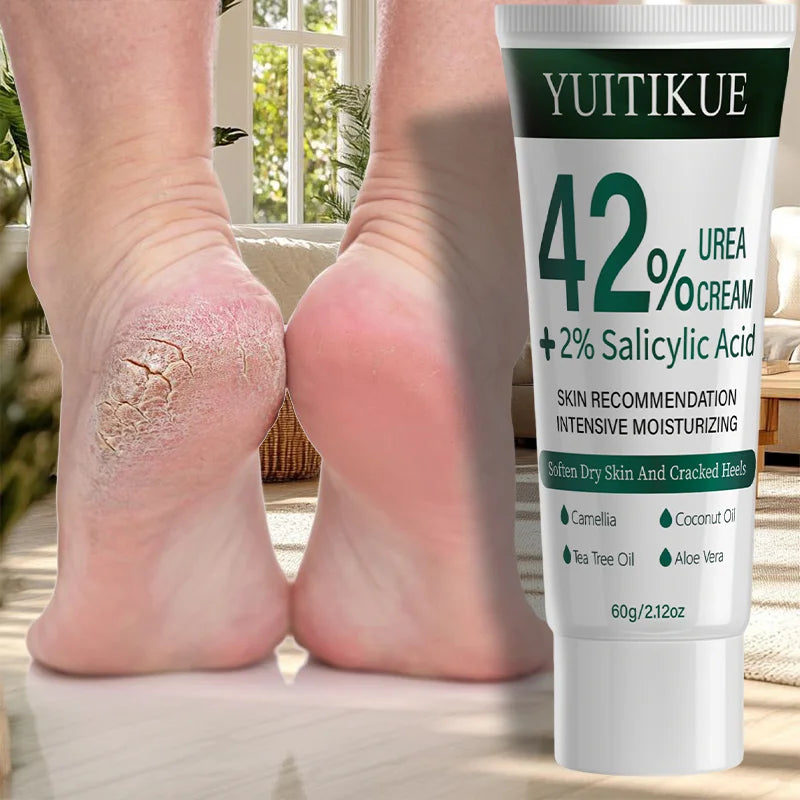 Yuitikue 42% Urea Cream with 2% Salicylic Acid, 60g Intensive Moisturizing Cream for Softening Dry Skin & Cracked Heels Peaceful Pleasures Health and Wellness