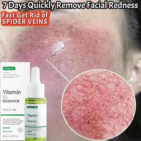 Facial Redness Repair Serum | Sensitive Skin & Rosacea, 30ml Facial Repair Serum Peaceful Pleasures Health and Wellness