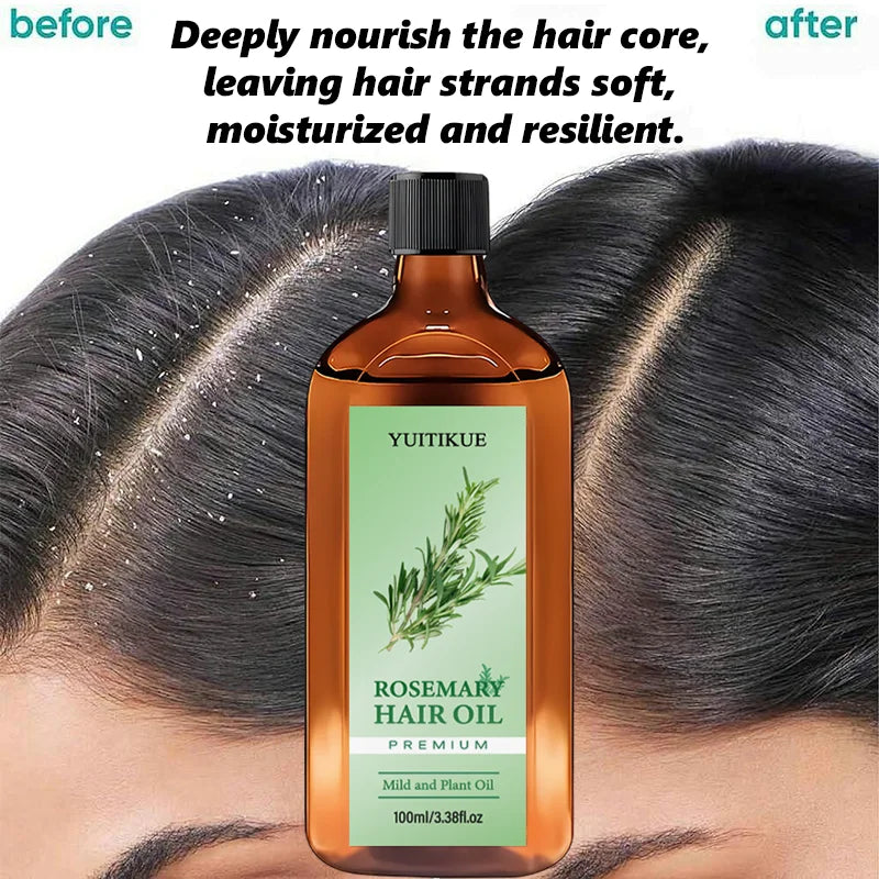 YUITIKUE Premium Rosemary Hair Oil | Mild Plant-Based Formula | For Gentle Hair & Scalp Nourishment & Healthy Hair Care 100ml Peaceful Pleasures Health and Wellness