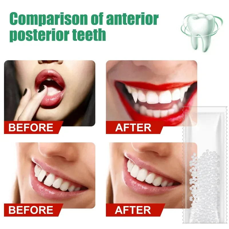 Temporary Tooth Repair Kit – Resin Denture Adhesive & Gap Filler