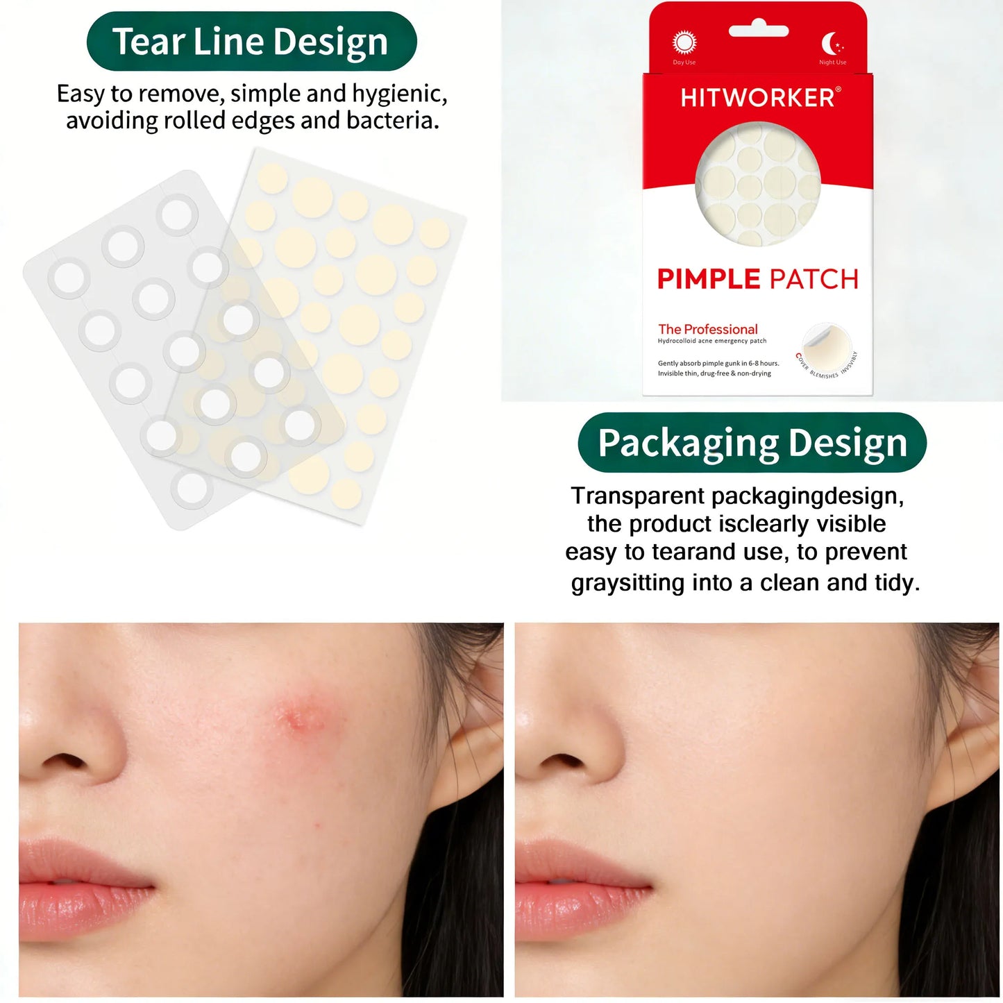 Invisible Waterproof Hydrocolloid Acne Patches – All Skin Types