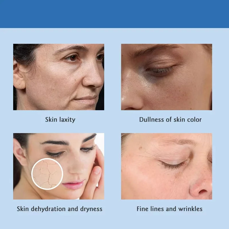 SANENDI Hyaluronic Acid MicroInfusion Stamp Face Serum Kit