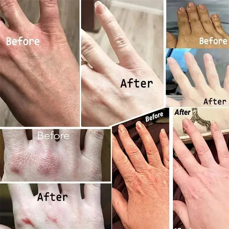 Wrinkle Removal Hand Cream Skin Soften Nourish Anti Drying Cracked Fade Fine Lines Whitening Moisturiz Repair Skin Care Products Peaceful Pleasures Health and Wellness
