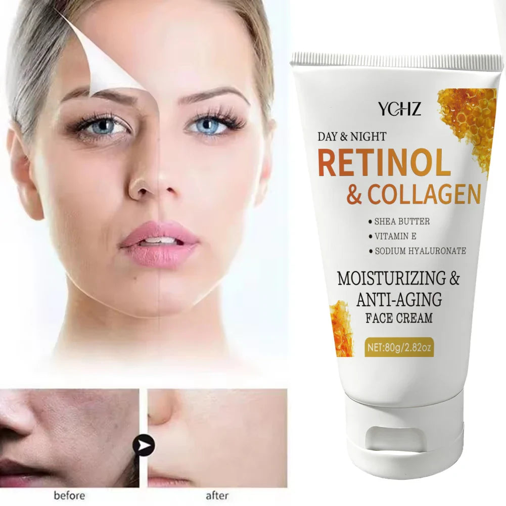 Retinol Night Cream with Collagen & Hyaluronic Acid – Face & Neck