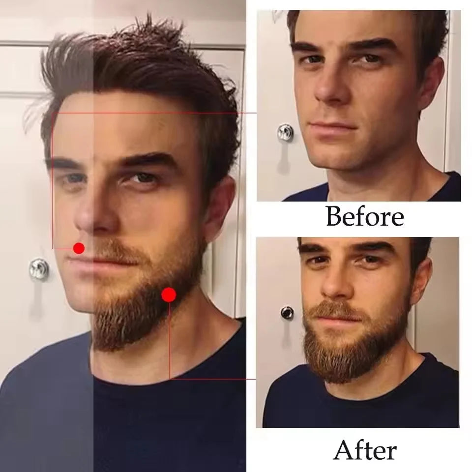 Beard Growth Serum Oil for Men – Thicker & Fuller Beard