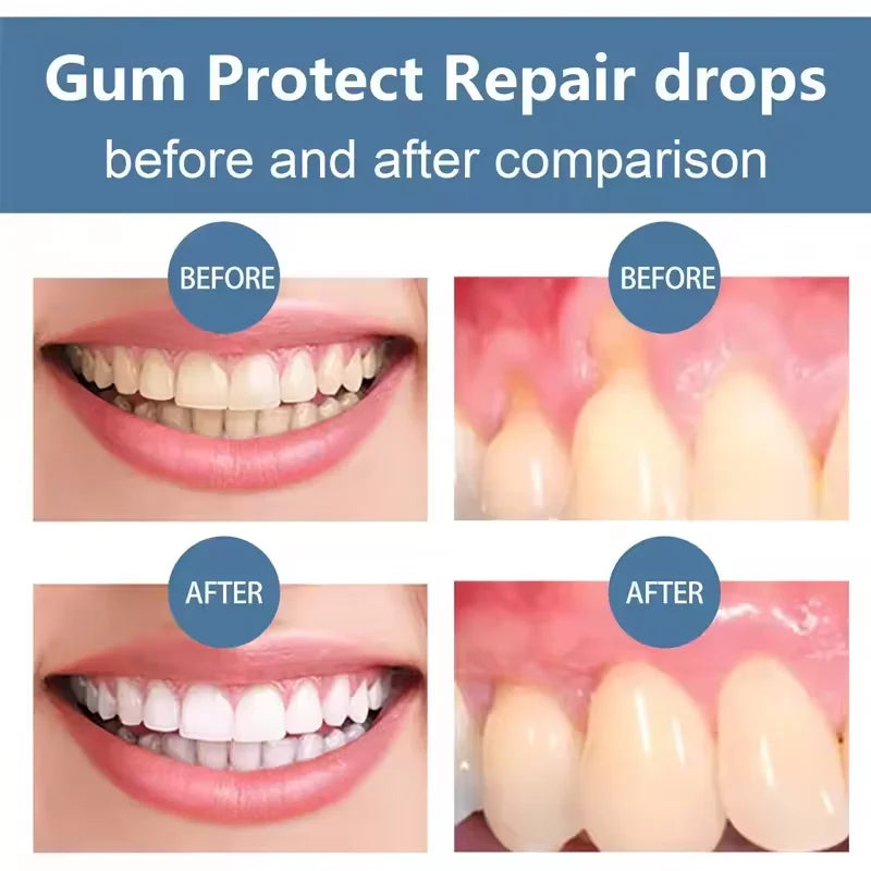 Damaged Gum Repair Care Gel Relieve Sore Gums Allergy Deep Cleaning Teeth Stains Tartar Serum Dental Caries Toothpaste Products Peaceful Pleasures Health and Wellness