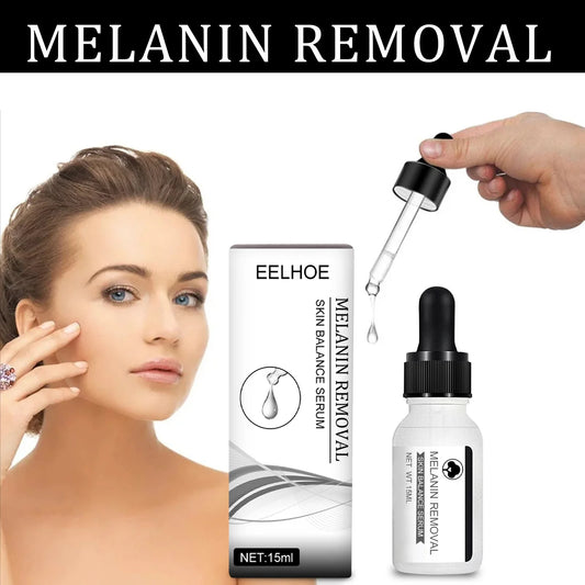 Niacinamide Dark Spot Serum – Fade Melasma & Brighten Skin