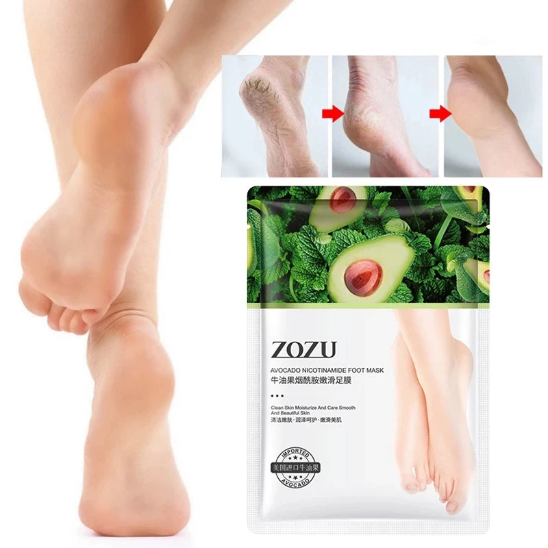 5-Pair Avocado Exfoliating Foot Mask – Dead Skin Remover