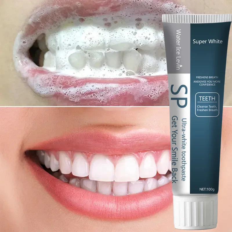 SP Probiotic Whitening Toothpaste – Stain Removal & Fresh Breath