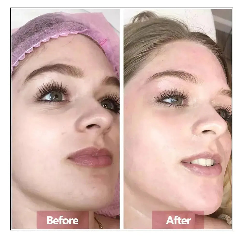 Hyaluronic Acid Face Serum – Anti-Aging, Firming & Hydrating