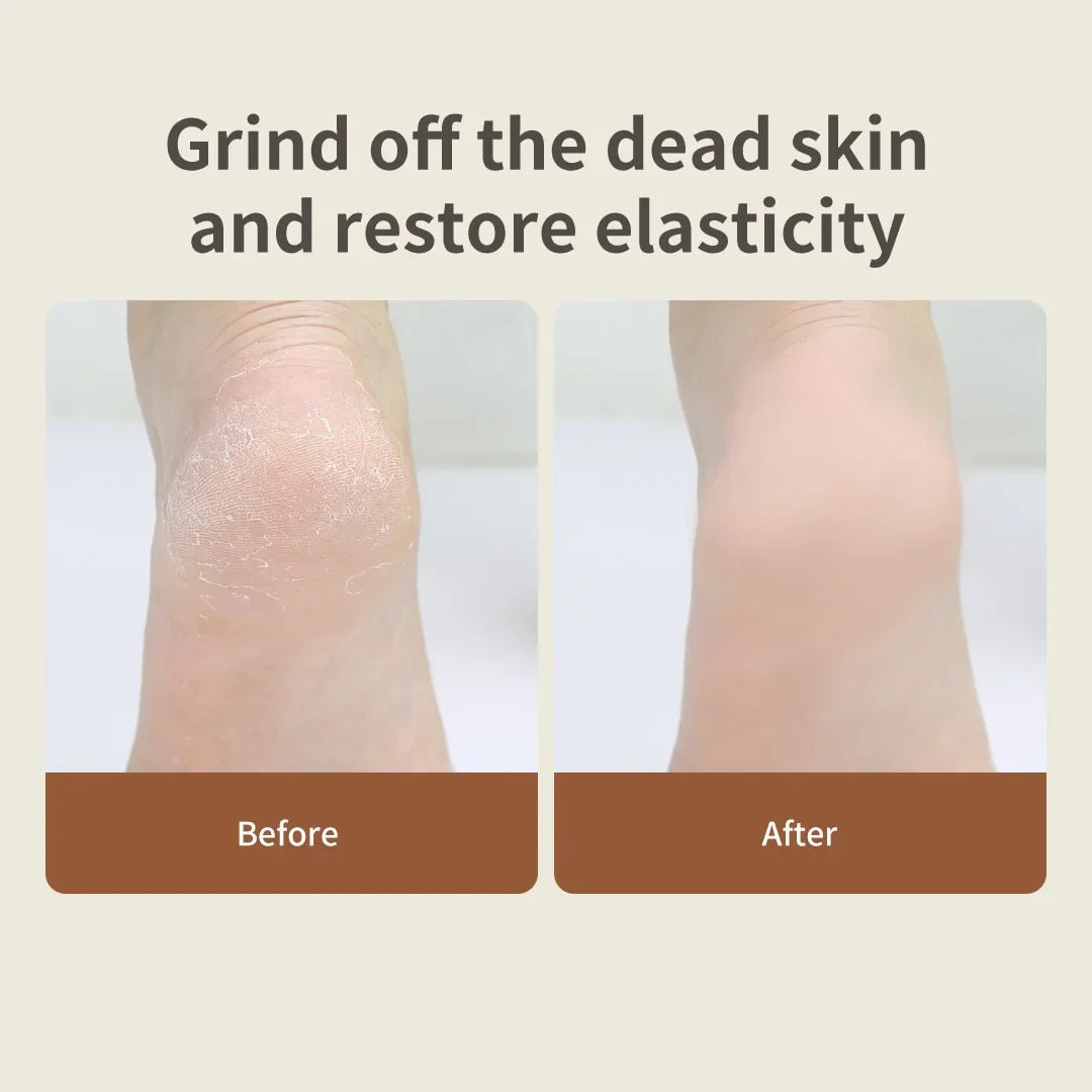 DOCO LAB Electric Foot Grinder | Rechargeable Pedicure Tool