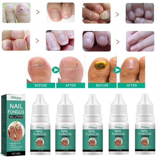 5-Pack Nail Repair Serum | Nail Restoration Essence 10ml Nail Repair Serum Peaceful Pleasures Health and Wellness 5PCS