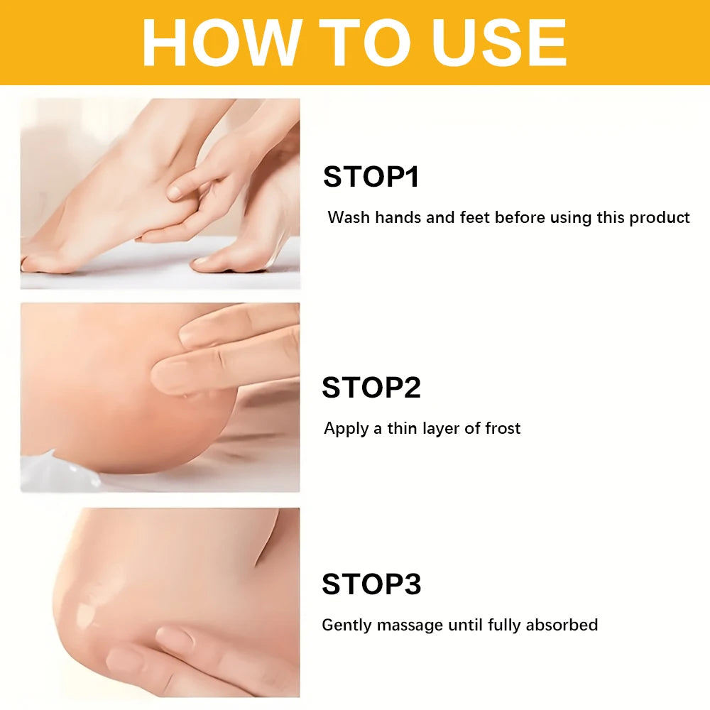 60% Urea & 2% Salicylic Acid Foot Cream for Cracked Heels - Exfoliating, Moisturizing, Hard Skin, Callus & Dead Skin Remover. Peaceful Pleasures Health and Wellness