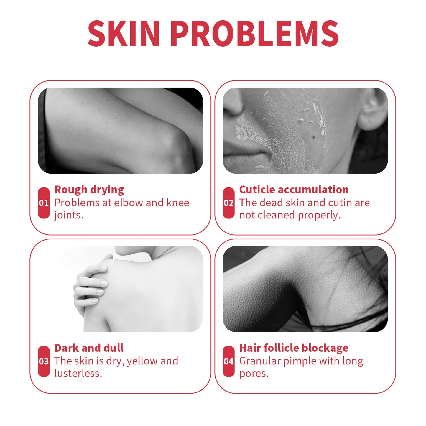 OUHOE Exfoliating Peeling Gel – Face & Body Scrub 50g