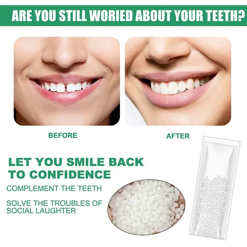 Temporary Tooth Repair Kit – Resin Denture Adhesive & Gap Filler