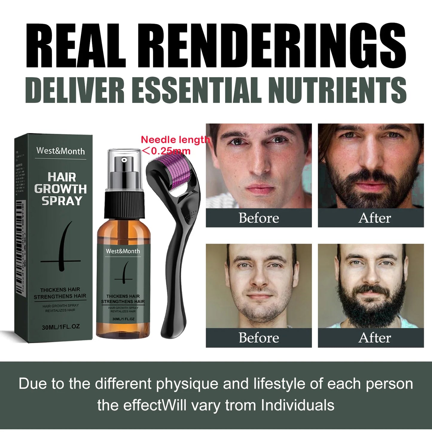 Men's Beard Growth Spray Kit with 0.25mm Micro Roller – 30ml Peaceful Pleasures Health and Wellness