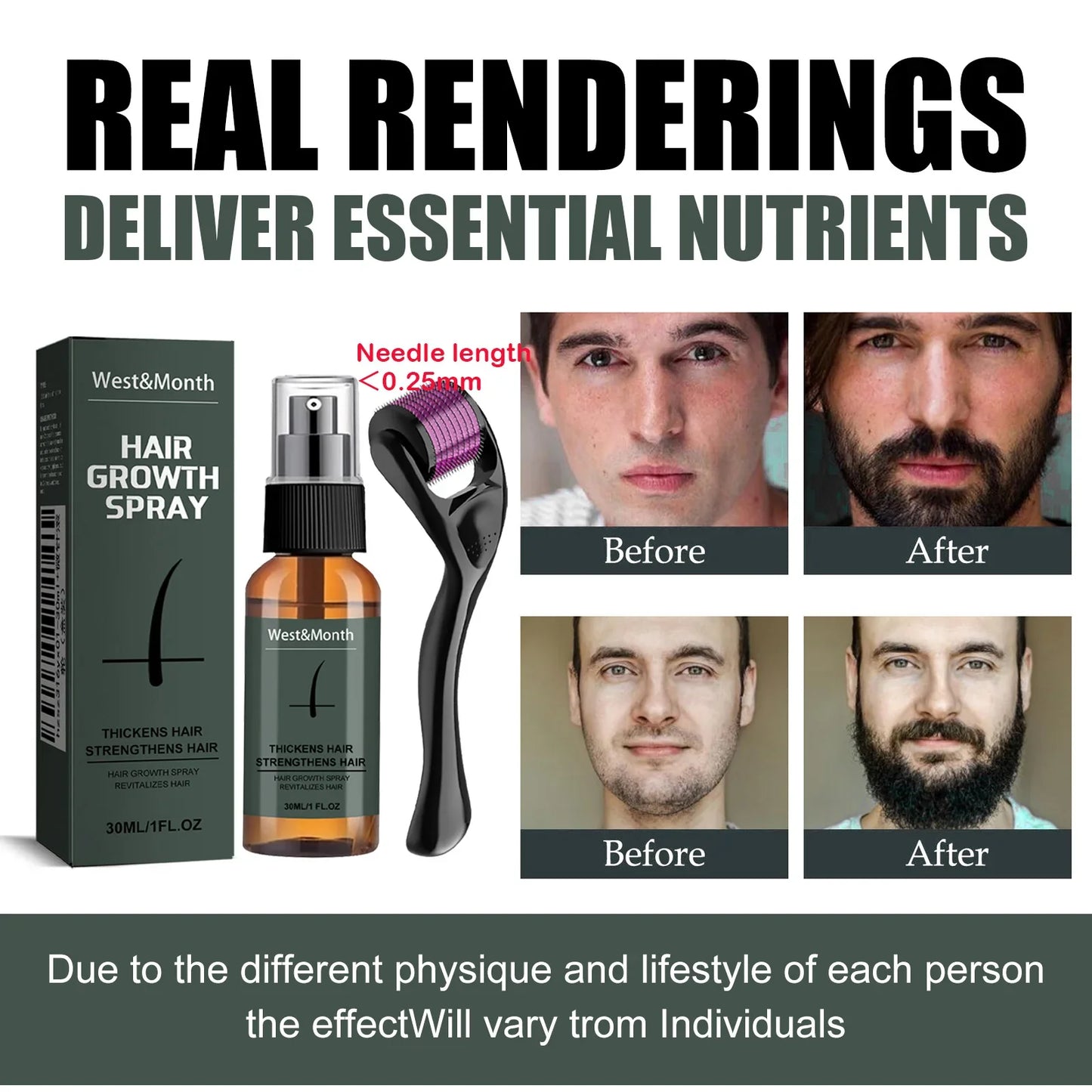 Men's Beard Growth Spray Kit & 0.25mm Micro Roller – 30ml