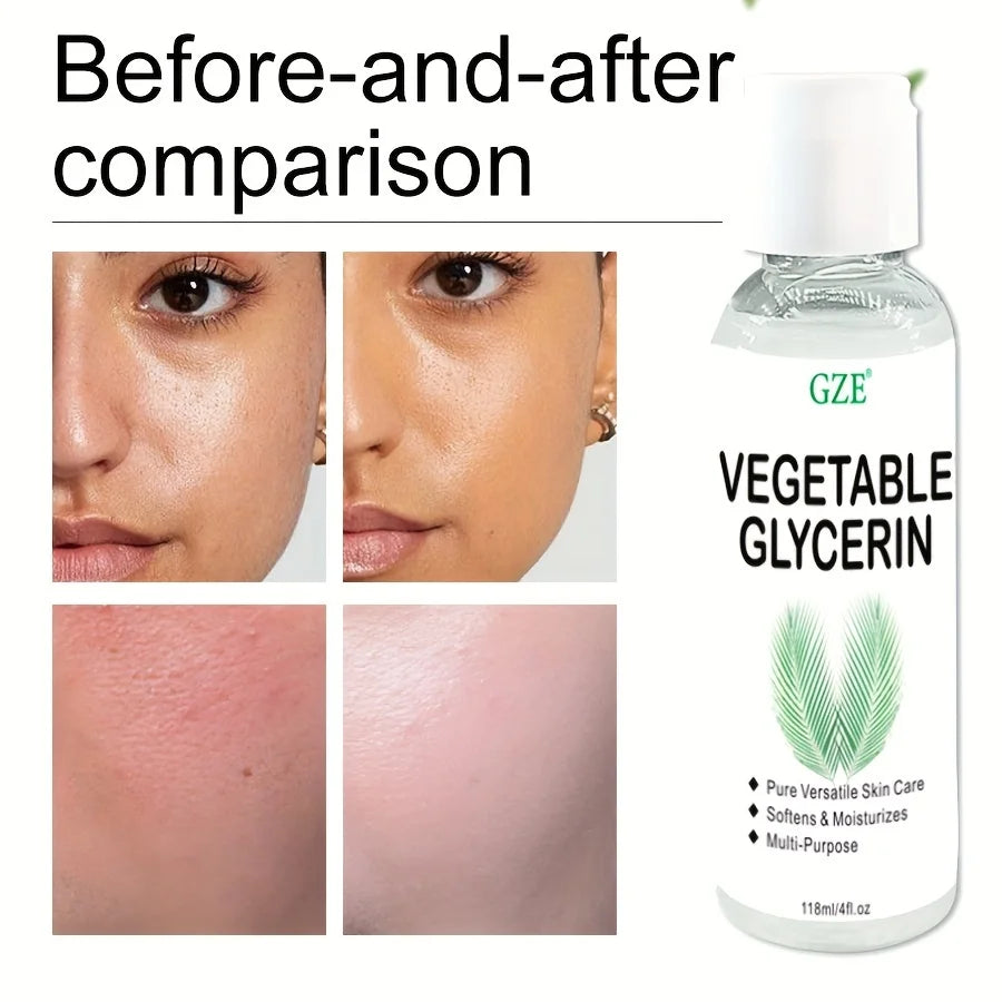 GZE 100% Pure Vegetable Glycerin Moisturizer – 118ml Skin Care