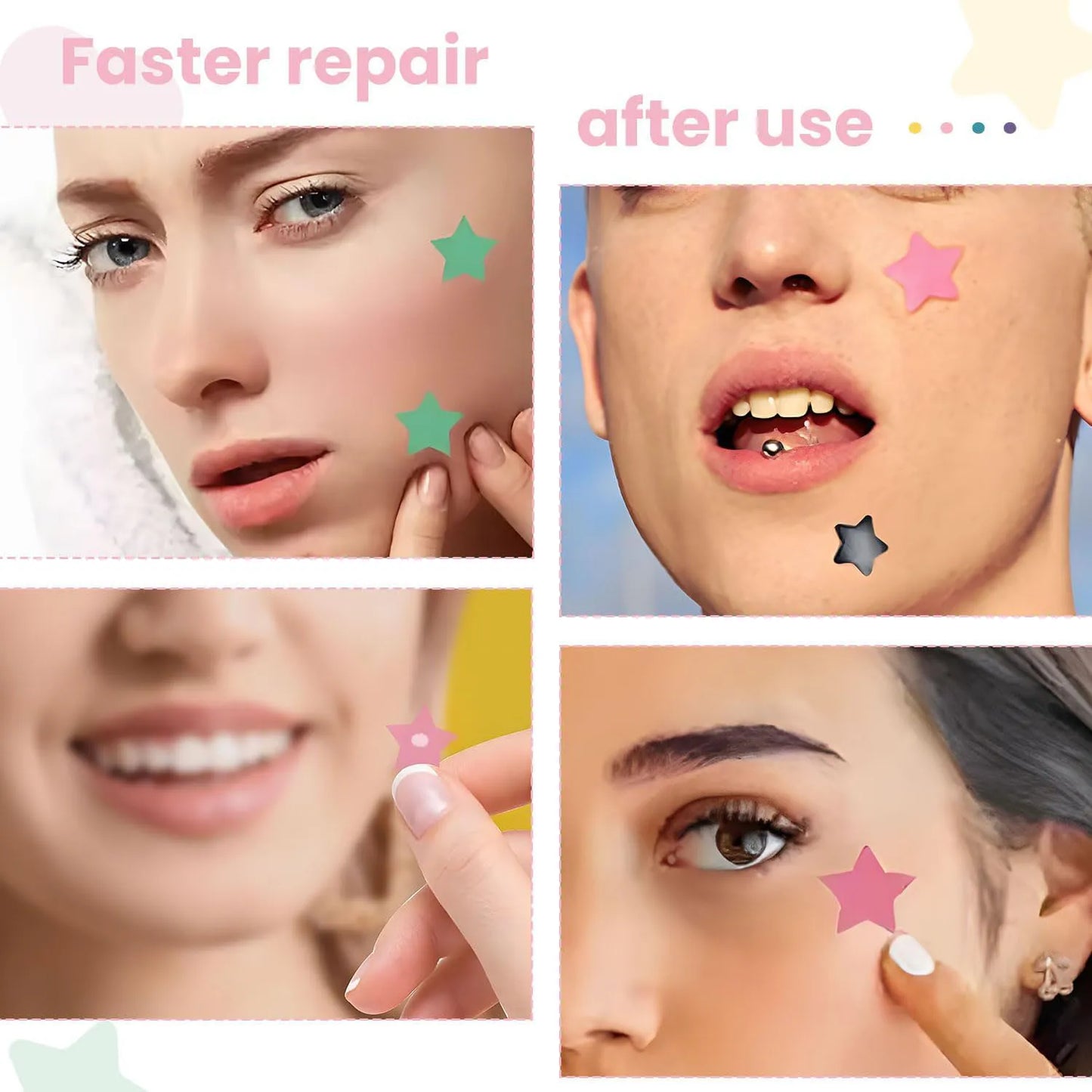 Invisible Waterproof Hydrocolloid Acne Patches – All Skin Types