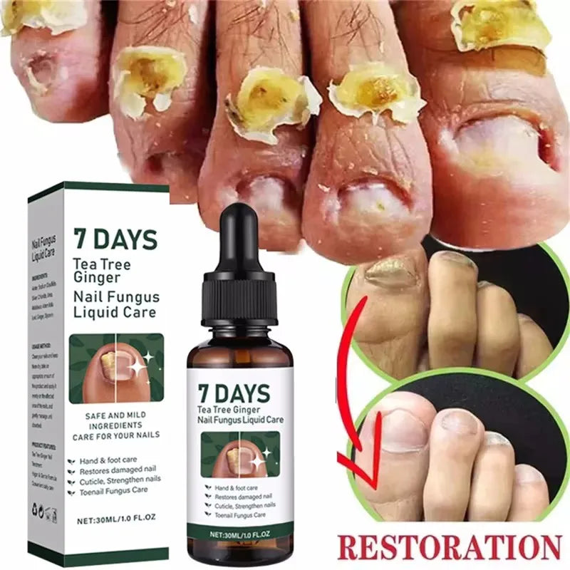 Eelhoe Nail Repair Serum – Ginger Extract for Healthy Nails