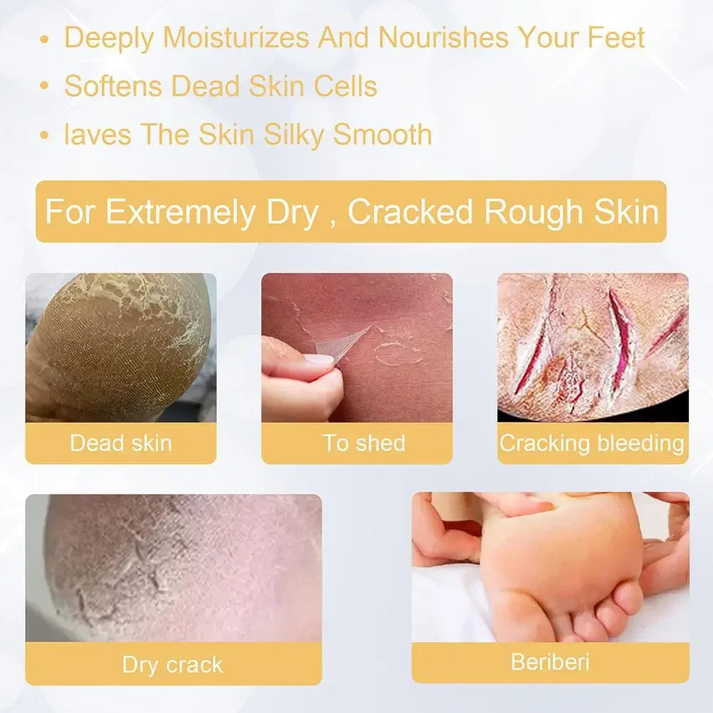 200ml Foot Peeling Spray Moisturizing Nourishing Foot Exfoliator Spray, Smoothing Feet Skin, Gently Exfoliates Rough Dry Skin Peaceful Pleasures Health and Wellness