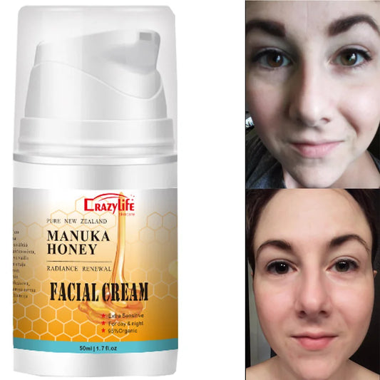 50ml NewZealand Bee Venom Honey Facial Cream Firming Lifting Skin Treatment Facial Cream Calming Night Cream Peaceful Pleasures Health and Wellness Default Title