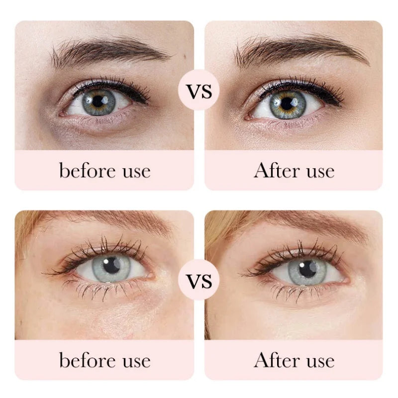 BIOAOUA Rose Hyaluronic Acid Eye Cream for Moisturizes Repairs Lightens Fine Lines Black Circles 20g Peaceful Pleasures Health and Wellness