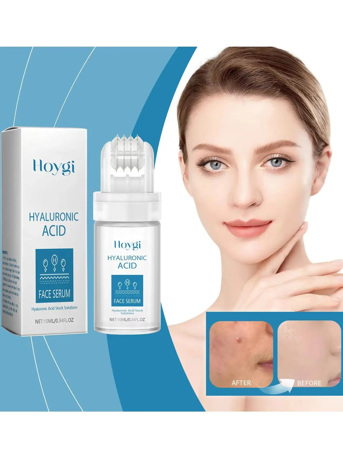 Hyaluronic Acid Microneedle Roller Serum – Brighten & Hydrate