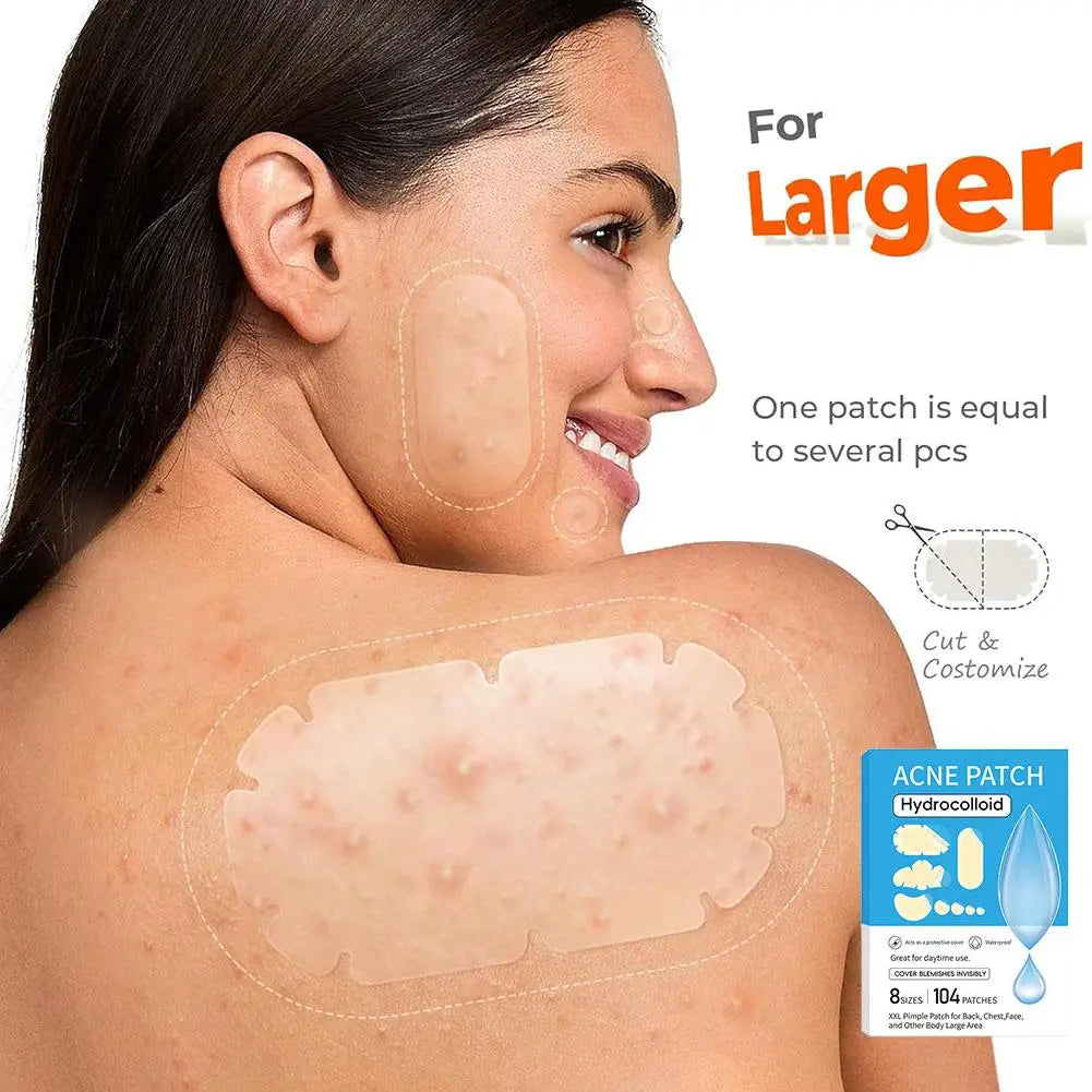 Hydrocolloid Pimple Patches – 5 Sizes, Bulk Pack Skin Care Peaceful Pleasures Health and Wellness